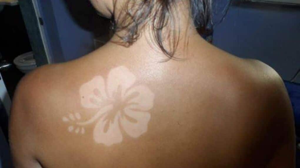 Sunburn Art, los tatuajes solares que pondrán en riesgo tu piel